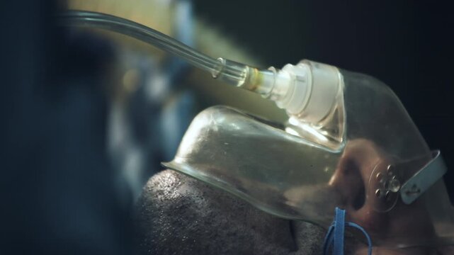 Close-up of anesthesia oxygen mask on patient during surgery in operating room