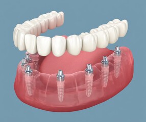 Detailed Visualization of Dentures and Human Teeth
