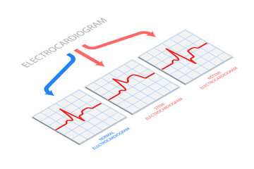 3D Isometric Flat  Illustration of Electrocardiogram, Diagnostics and Healthcare