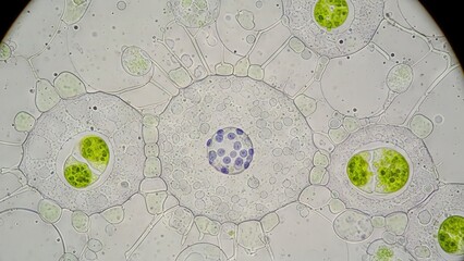 Microscopic view of plant cell nucleus and chloroplasts showing cellular structures