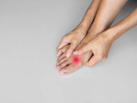 Sore ankle pain foot woman, sprain feet heel knee sore people chronic joint leg hurt injury bone arthritis skeleton girl accident fitness sport exercise medical care treatment massage, osteoarthritis