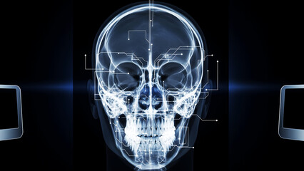 X-Ray Scan of Human Skull with Digital Circuitry and Tech Overlays