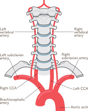 椎骨動脈、首元の動脈のイラスト Arteries in the neck illustration