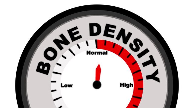 Bone Density text or word displayed with a barometer or tachometer-style gauge showing levels from low to normal to high, symbolizing bone health and osteoporosis risk