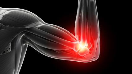  3D Illustration of Human Elbow Joint Pain and Inflammation