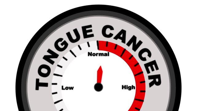 Tongue cancer text shown on a barometer or tachometer-style gauge, measuring stages and severity of oral malignancy