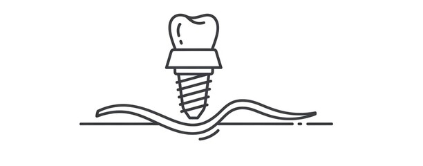 Dental Implant Illustration in Simple Line Art with Monochromatic Color on White Background for Medical Infographic