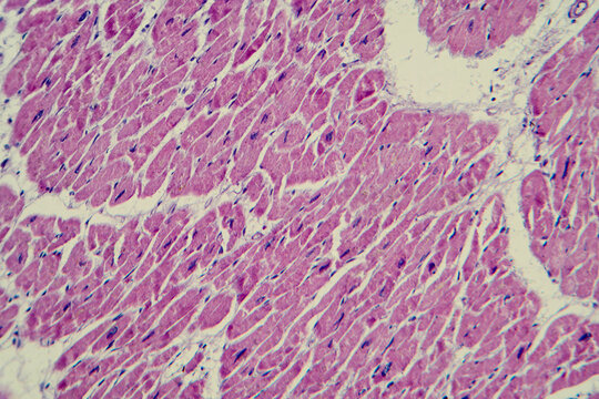 Cardiac hypertrophy, light micrograph
