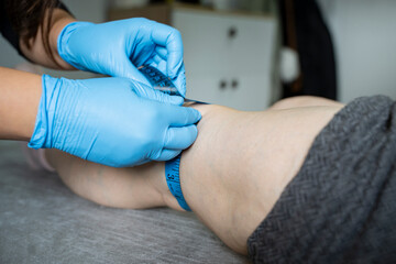 The physiotherapist is measuring the patient's leg with a tape measure. (stock photo)