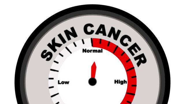Skin Cancer text with a barometer or tachometer-style gauge, showing varying levels of severity in tumor growth, spreading, and skin changes