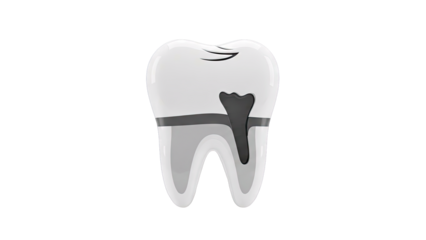 Tooth Decay Illustration