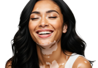 Beautiful woman with vitiligo smiling with closed eyes isolated on transparent background