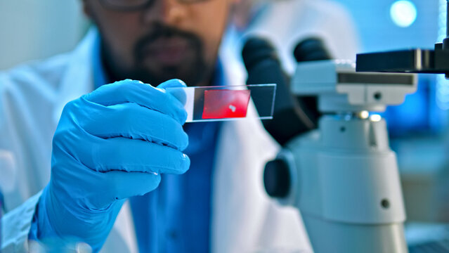 A scientist in a lab coat and blue gloves examines a red sample under a microscope, highlighting precision in a clinical research setting.
