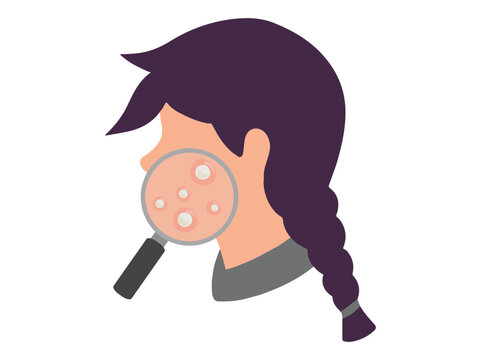 Acne Whitehead in Face Skin Illustration
