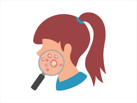 Acne Pustule in Face Skin Illustration
