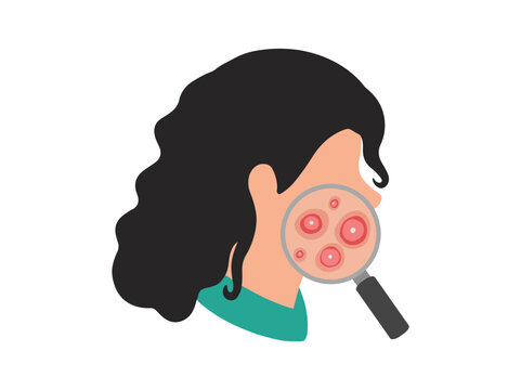 Acne Cystic in Face Skin Clip Art
