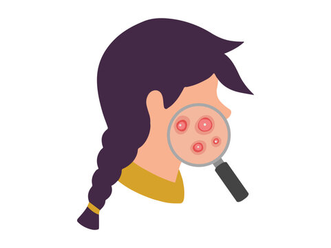 Hand Drawn Acne Cystic in Face Skin
