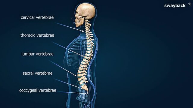 Sway back condition of the spine.