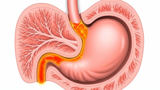 Human Stomach Anatomy Animation Showing Acid Reflux and GERD