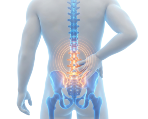 A digital illustration of a human spine highlighting pain areas in the lower back, with glowing effects to indicate discomfort.