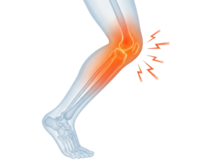 A depiction of a human leg with an emphasis on the knee joint, highlighting areas of pain through glowing effects.