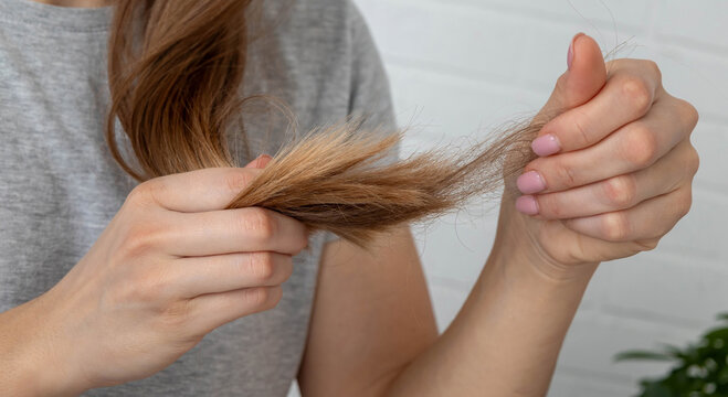 Woman looking at fallen hair in her hand. Alopecia and hair care problem concept
