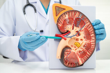 Kidney disease, Chronic kidney disease ckd, Doctor hold human model to treat and study in hospital.