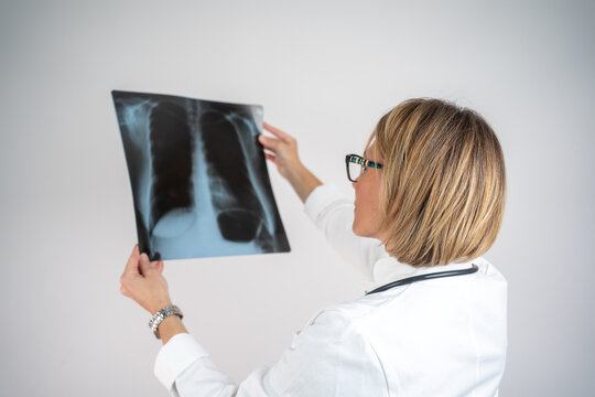 Female doctor examining a lung radiography