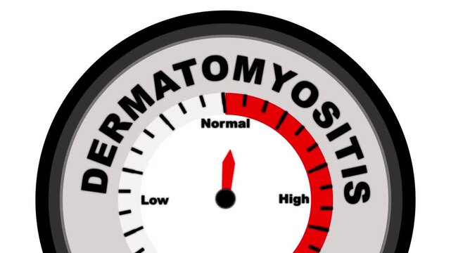 Dermatomyositis text or word shown with a barometer or tachometer-style gauge, representing varying levels of skin and muscle inflammation severity
