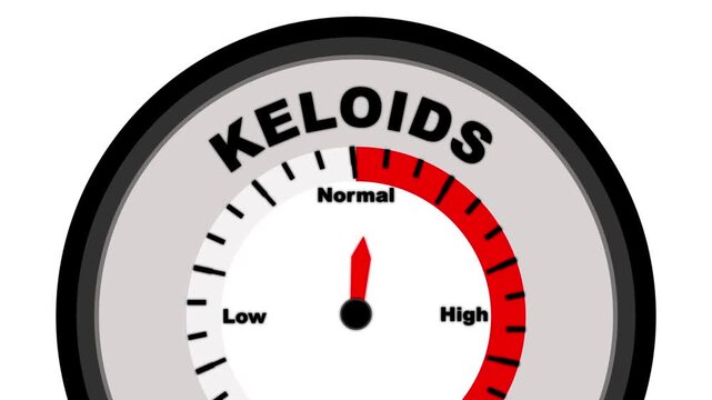 Keloids text or word shown with a barometer or tachometer-style gauge, representing varying levels of severity in the growth of thick, raised scars following skin injury