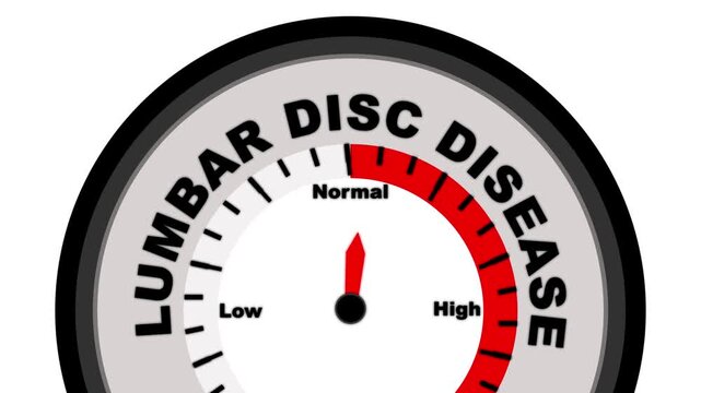 Lumbar Disc Disease text or word shown with a barometer or tachometer-style gauge, representing varying levels of severity in spinal disc degeneration and impact on mobility and pain