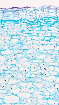Potato tuber tissue under the microscope. Stained tissue