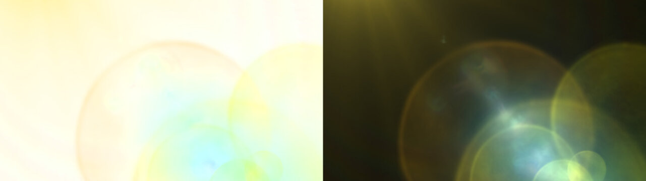 x ray image of human brain