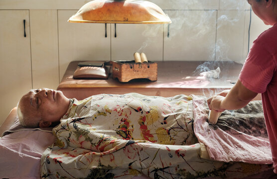 Moxibustion therapist is giving an Asian man a moxibustion treatment