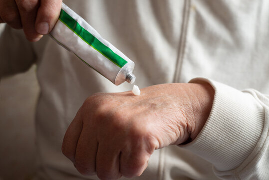 Anonymous woman squeezing ointment from tube onto hand
