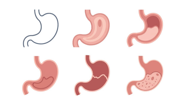 Illustrative stages of the human stomach, highlighting its function and conditions