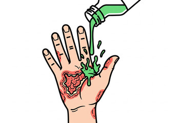 Cartoon hand with wounds being poured with green antiseptic liquid