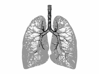 An anatomical illustration depicting the human lungs and bronchial pathways