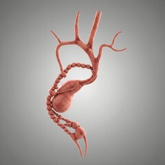 medical illustration showing a gallbladder with thickened ducts that appear "beaded" or irregular due to scarring. Realistic 3D anatomy, soft lighting, neutral background.