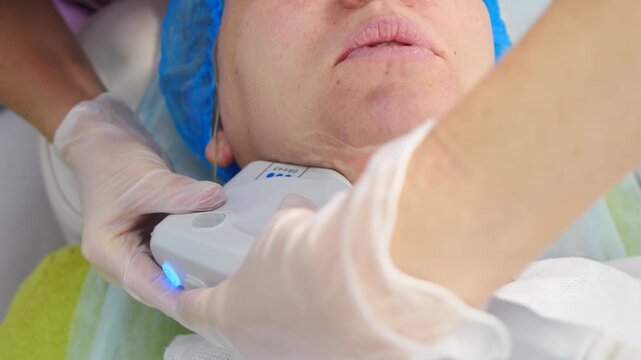 Smas lifting anti-aging therapy. Hardware cosmetology concept. non-surgical face lifting treatment. ultrasonic device, facial skin rejuvenating procedure in modern beauty clinic. wrinkle reducing on
