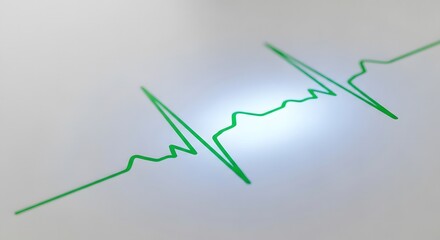 Close up of a green electrocardiogram heartbeat line on white paper
