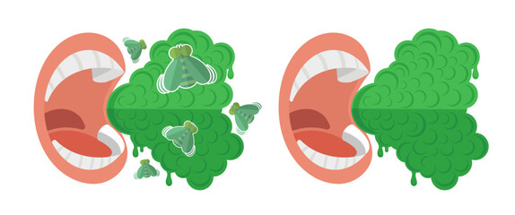 Person Breathing Bad Breath From Mouth. Open Mouth With Cloud of Green Unpleasant Odor. Vector illustration In Flat Style Isolated On White. 