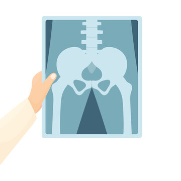 A doctor's hand in a white coat holding an X-ray of the pelvis against a white background. Concept for diagnosing bone problems and fractures. Elements of medicine. Pelvic floor.