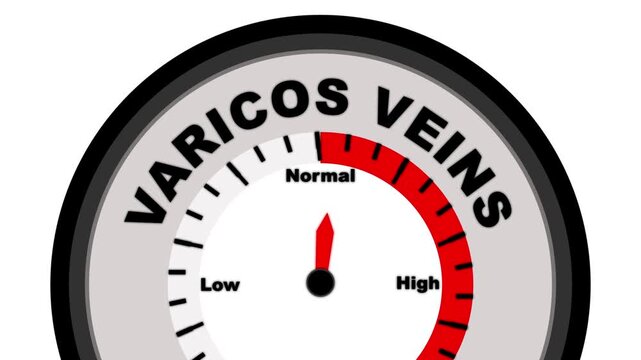 Varicose Veins text or word with a barometer or tachometer-style gauge, illustrating varying levels of vein enlargement and circulatory discomfort