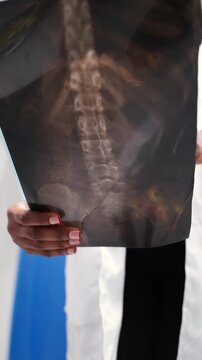 Vertical video, African female doctor examines X-ray of pelvis in hospital