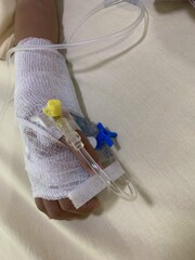 child hand arm wrapped in white medical gauze. intravenous cannula with yellow port is attached,...
