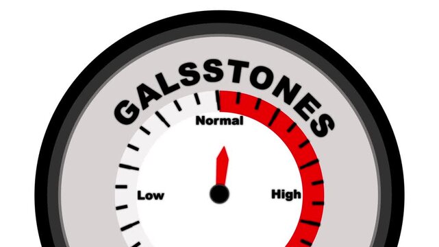 Gallstones text or word shown with a barometer or tachometer-style gauge, representing varying levels of gallstone formation and severity of symptoms such as pain and bile duct blockage