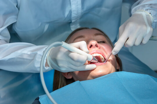 Dentist performing professional dental cleaning using scaler and suction during oral hygiene procedure. Preventive dentistry treatment in a modern clinic with sterile conditions.