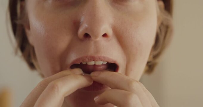 Close-up of a woman inserting a clear dental aligner at home &mdash; modern teeth straightening and daily oral care concept.