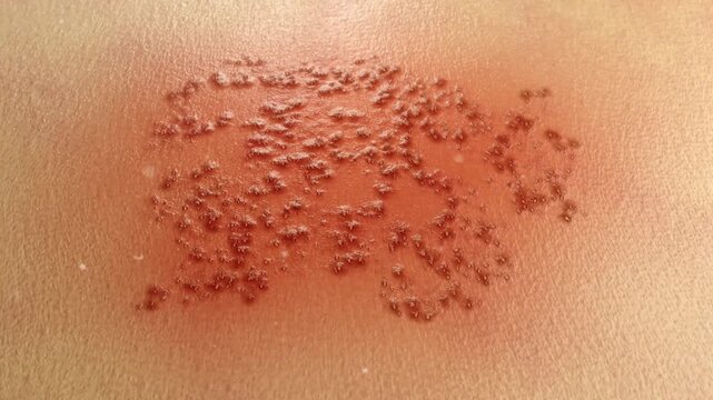 Repair red papules on the skin, essence and gel to repair damaged skin and shingles. Inhibit melanin and pigmentation, activate deep skin cells, concept skin care beauty. Cosmetics ads, 3D rendering.